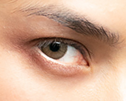 Auge mit Kontaktlinse